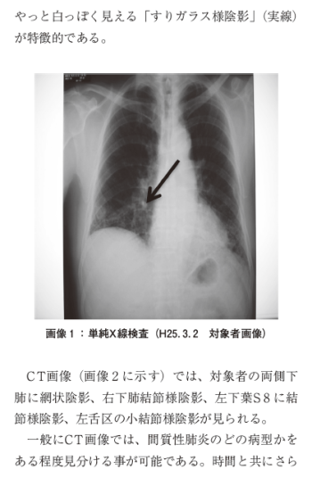 特発性肺線維症の一症例 ～呼吸器リハビリテーションの評価と施術～の表紙